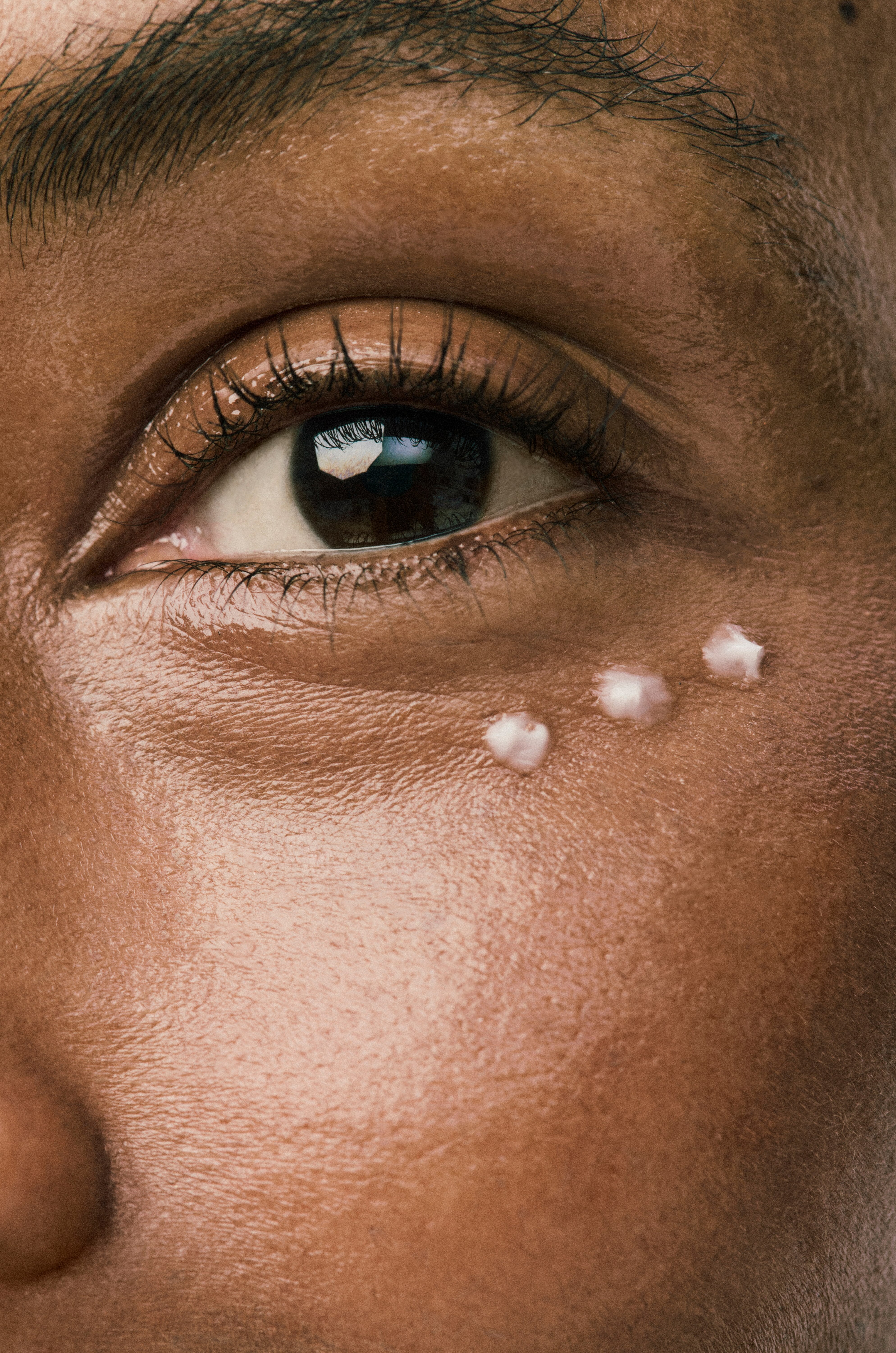 Close-up of a person's eye with 3 dots of product